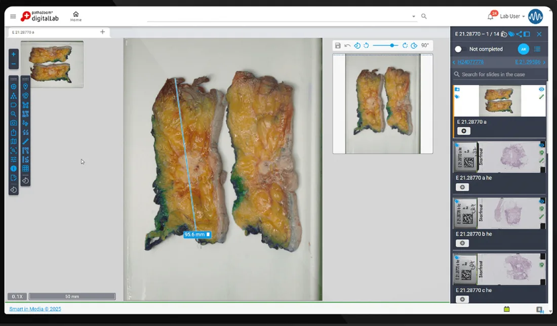 PathoZoom Digital Lab case view with a measured specimen and slide list